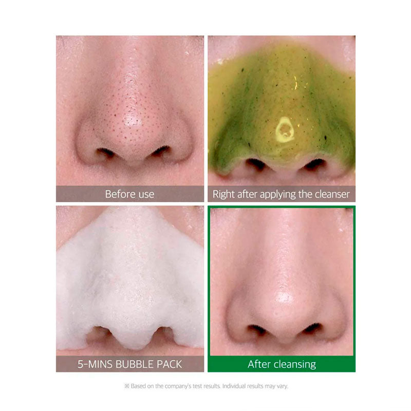 Bye Bye Blackhead Korean Skincare Bubble Cleanser After