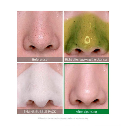Bye Bye Blackhead Korean Skincare Bubble Cleanser After